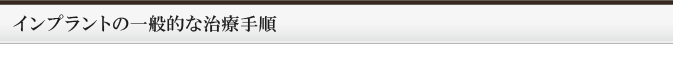 インプラントの一般的な治療手順