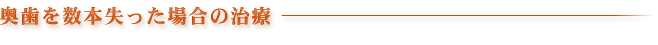 奥歯を数本失った場合の治療