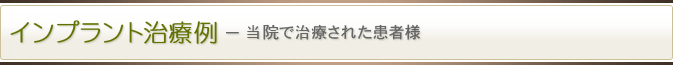 インプラント治療例－当院で治療された患者様