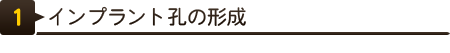 インプラント孔の形成